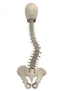 Scoliosis