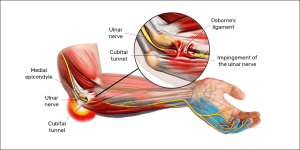 cubital sindrome anatomy