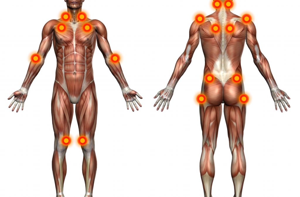 fibromialgjia